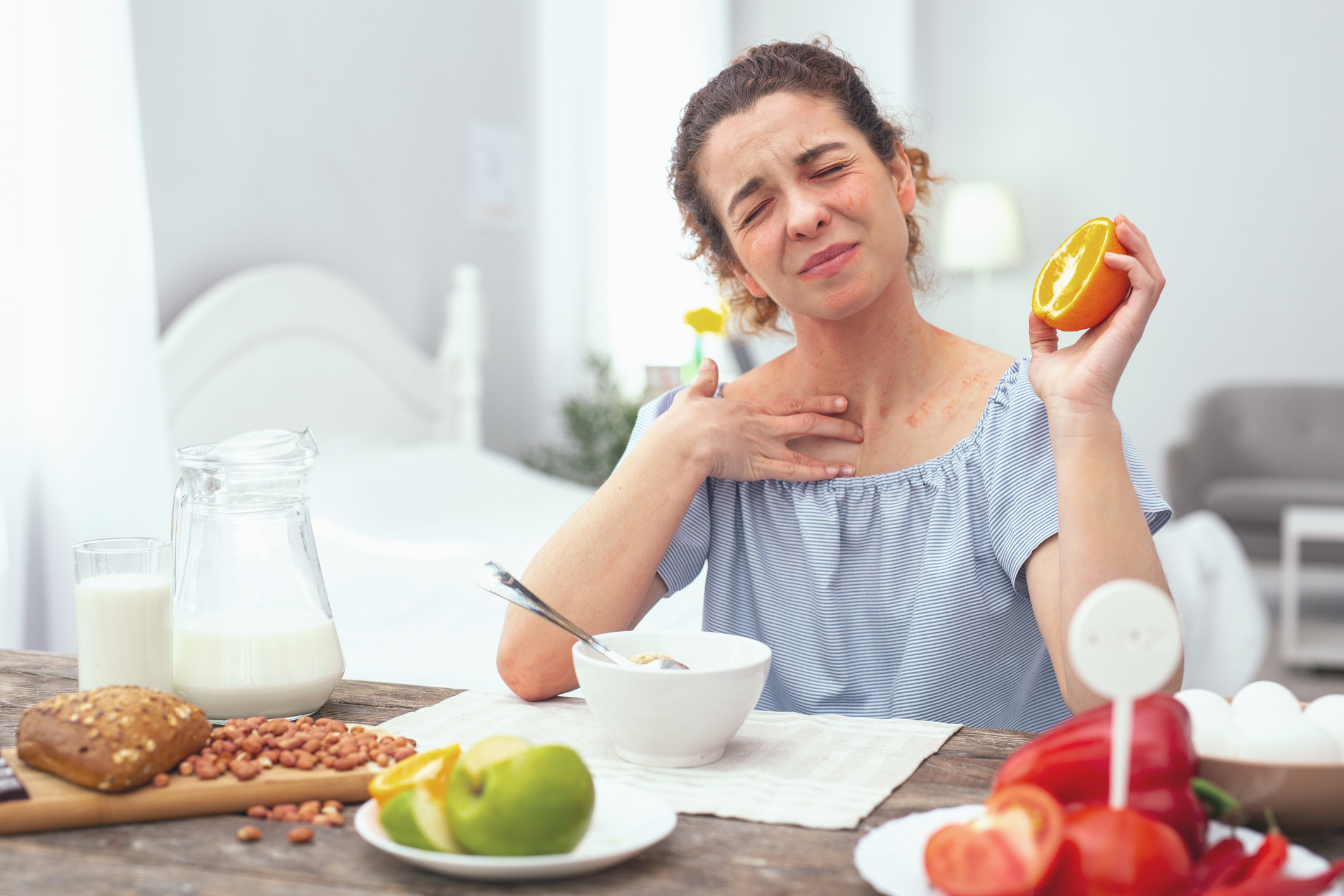 アトピー性皮膚炎では、柑橘類は禁止されている