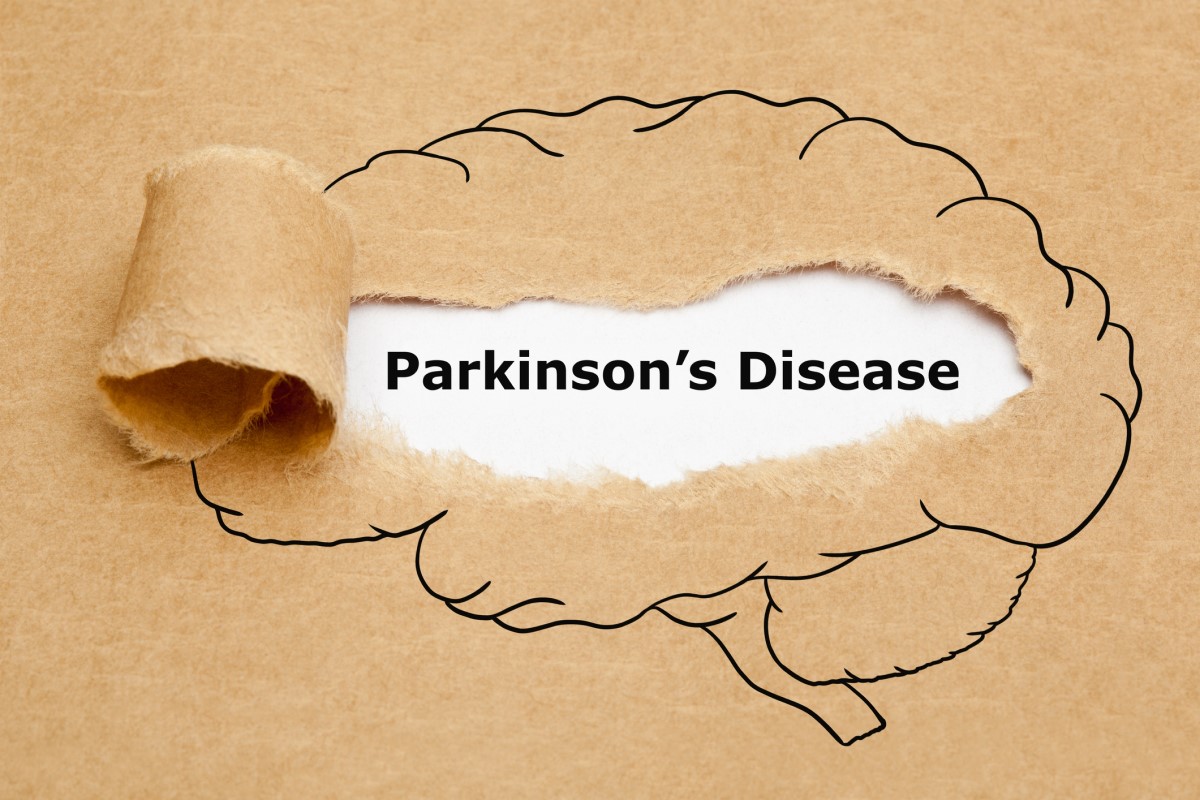 Morbus parkinson = Parkinsons disease = パーキンソン病 - パーキンソン病が真ん中にある脳のアニメーション