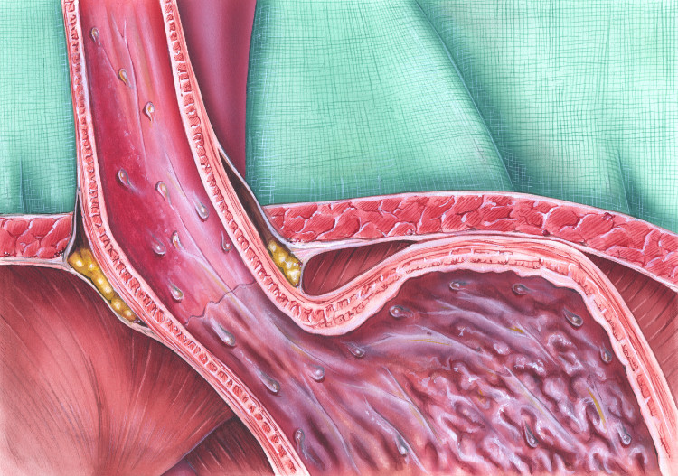 解剖学的に描かれた食道括約筋