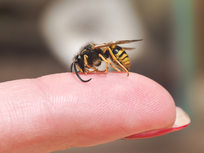 指の上に座るスズメバチ、虫刺されアレルギーの兆候