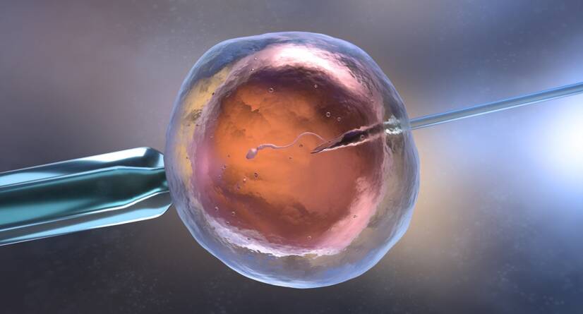 体外受精 IVF：Getty Images